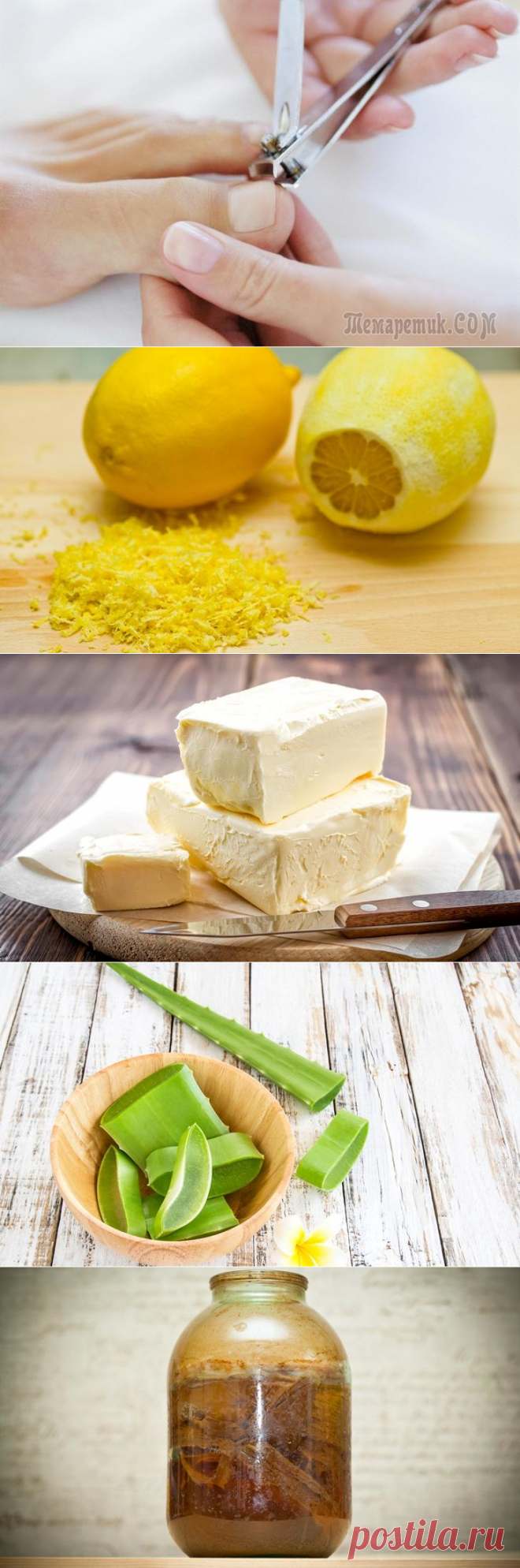 Вросший ноготь: 10 народных средств избавления от проблемы