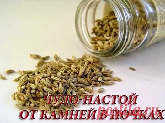 Всё самое интересное!: Какие камни нам не нужны? Камни в почках