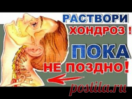Как излечить шейный остеохондроз навсегда? Простым эффективным методом. | Здоровые и красивые | Яндекс Дзен