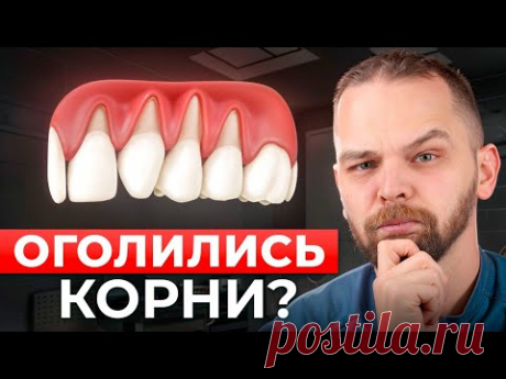 смотреть комментарии обязательно....Опустилась десна? Вот что нужно сделать