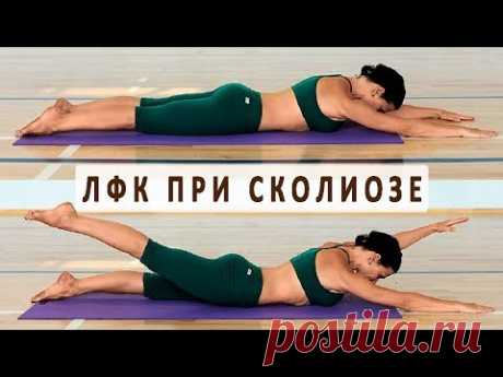 Упражнения ЛФК при сколиозе