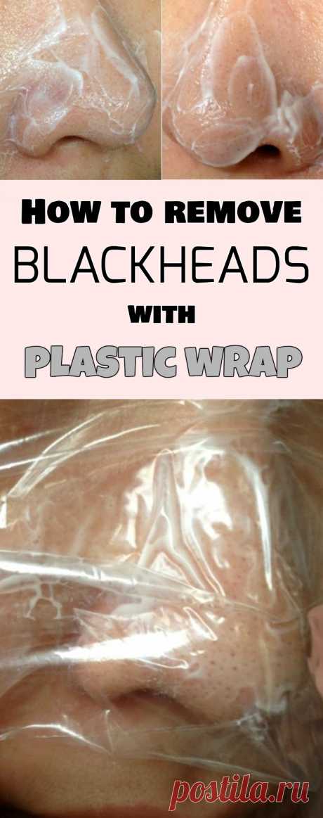 Remove Blackheads with Vaseline and Plastic Wrap in 5 Minutes Without any Pain. It is so easy!