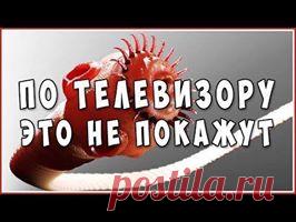 Паразиты. Глисты. Гельминты в организме человека. Последствия. Защита. Лечение.