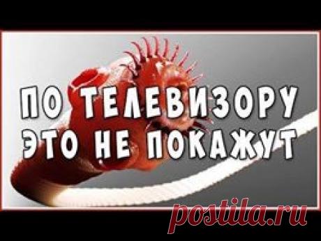 Паразиты. Глисты. Гельминты в организме человека. Последствия. Защита. Лечение.