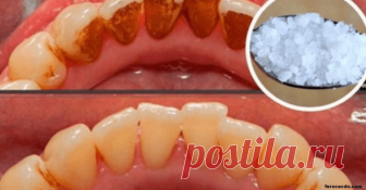 Замучил зубной камень? Избавьтесь от него легко и просто!  Всем известно, как важно сохранить здоровье зубов. Ведь, к сожалению, наши зубы не восстанавливаются самостоятельно. Если бы они росли так же, как волосы или ногти, то не было бы таких очередей к сто…