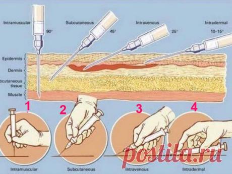 Как делать инъекции самостоятельно