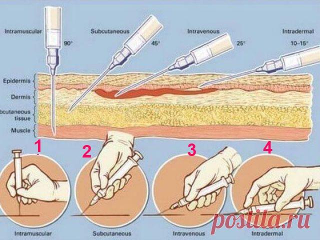 Как делать инъекции самостоятельно
