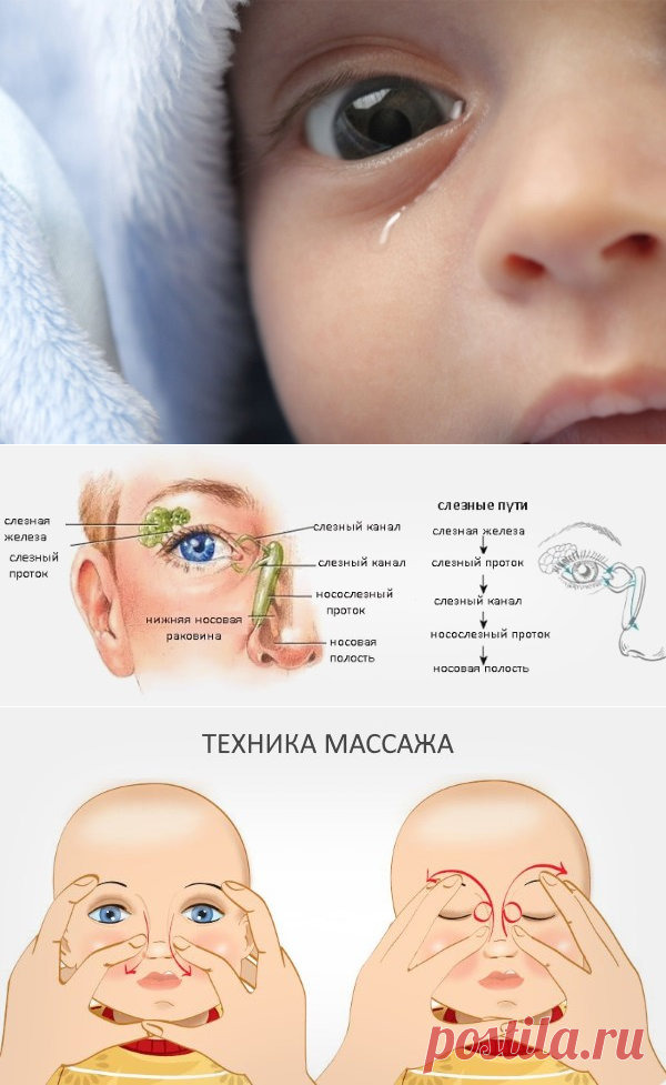 Дакриоцистит у новорожденных (детей): лечение, симптомы (фото), причины непроходимости слезного канала, массаж