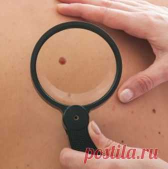 Красные родинки на теле. Причины появления. – Женский сайт Femme Today Красные родинки, которые появляются на нашем теле, заставляют нас пугаться и тревожиться. Обыкновенно они не беспокоят, но выглядят не эстетично. Они появляются чаще всего в области шеи, груди, на спине. В медицинской практике красные родинки принято относить к доброкачественным образованиям, которые состоят из лимфатических или кровеносных сосудов. Их появление объясняется нарушениями функционирования ...