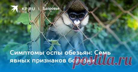 26-5-22-Симптомы оспы обезьян: Семь явных признаков болезни Названы главные симптомы оспы обезьян