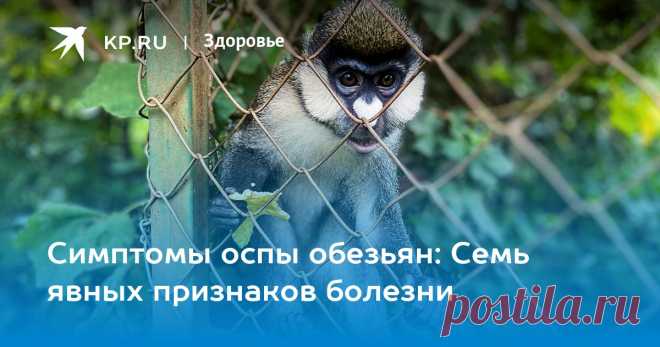 26-5-22-Симптомы оспы обезьян: Семь явных признаков болезни Названы главные симптомы оспы обезьян