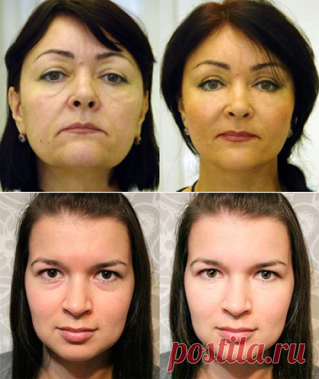 Подтяжка лица без пластической хирургии | Cledbel Ultra Lift 24k gold | Блог Елены Марковой