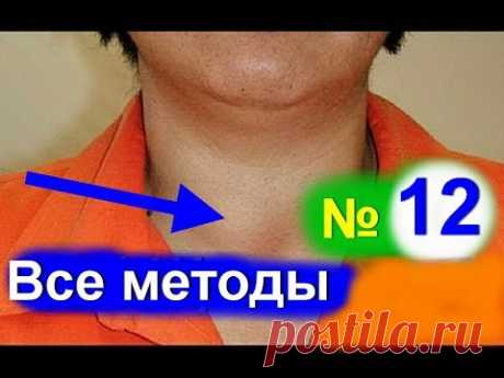 Лечение щитовидной железы! Узловой зоб. Как лечить щитовидку народными средствами №12| #зоб #edblack