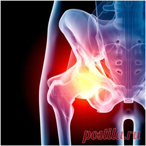 Упражнения при артрозе тазобедренного сустава Суставы — это довольно хрупкая структура, они остаются здоровыми и эластичными лишь, когда соблюдается двигательная активность (движение – жизнь), и если они не перегружаются. Молодостью об этом почти никто серьёзно не задумывается, — их надёжная работа считается само собой разумеющимся, кажется, так будет всегда. Однако со временем на суставы и их работу приходится обратить более пристальное внимание, как правило, они