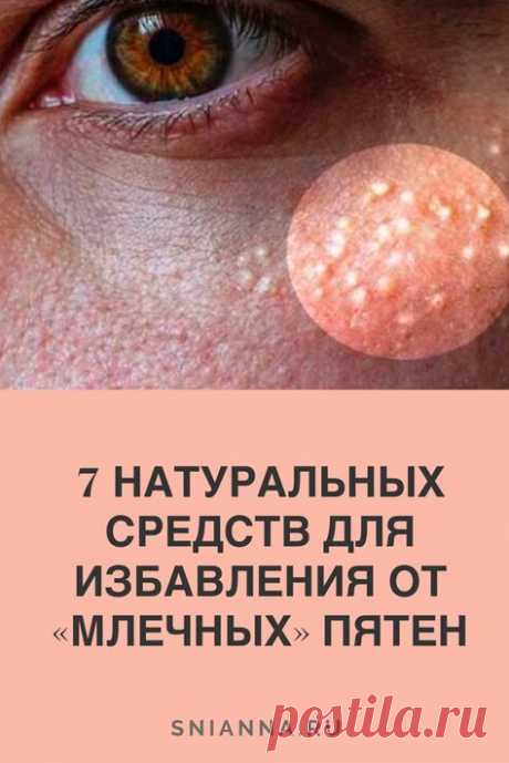 Выберите любое из этих природных средств и немедленно избавьтесь от млечных пятен!  Если вы заметили белые, поднятые шишки на коже, которые не исчезают, вы должны знать, что это не прыщи. #красота #здоровье #уходзакожей