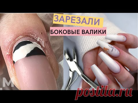 ИСКРОМСАЛИ КУСАЧКАМИ 😖 Сложный маникюр. ПОВРЕЖДЕННАЯ кожа. Наращивание ногтей БАЛЕРИНА💅