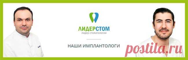 Зубные импланты: отзывы, цена в Москве, фото, видео