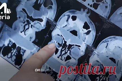 Российский подросток лишился глаза в тире. В Новокузнецке подросток, который работал в тире в парке Гагарина, лишился глаза. Об этом сообщает Telegram-канал Mash Siberia. По словам матери 17-летнего пострадавшего, к нему в тир пришел мужчина с двумя детьми. Сотрудник тира начал объяснять правила безопасности и выдал одному мальчику пистолет.