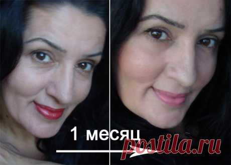 Омоложение лица без ботекса и операций! Способ доступен всем! ― С-Инструментс Медикал