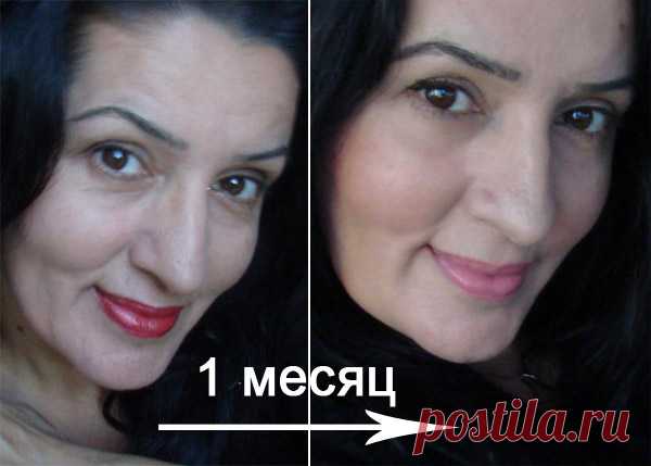 Омоложение лица без ботекса и операций! Способ доступен всем! ― С-Инструментс Медикал