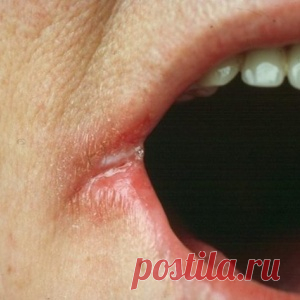 ОСТОРОЖНО! Сталкивались ли Вы хотя бы с одним из этих симптомов? Не игнорируйте их, потому что они могут быть плохими признаками!
