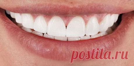 Идеальная улыбка без посещения стоматолога