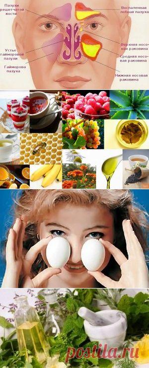 Средства от гайморита | Персональный блог Ларисы Лапинь
Сегодня, обладая огромными, казалось бы, возможностями и весьма обширным ассортиментом препаратов медицина не в состоянии решить проблему заболевания гайморитом. Порой, человеческие недуги не поддаются даже самым продвинутым лекарственным средствам. И тогда остается надежда лишь на рецепты народной медицины.