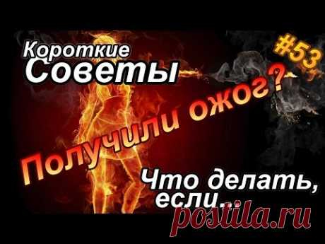 Что делать, если получили ожог?