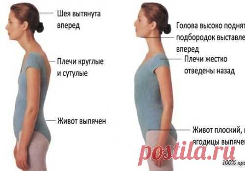 Если у вас сутулая спина, необходимо выполнять такие упражнения