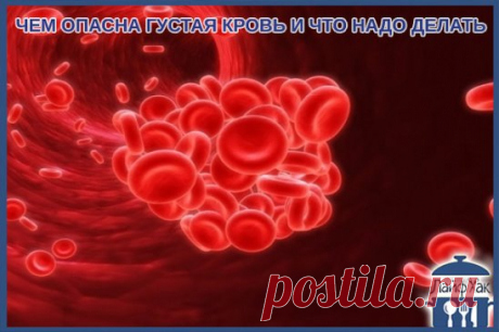ЧЕМ ОПАСНА ГУСТАЯ КРОВЬ И ЧТО НАДО ДЕЛАТЬ?
Некоторые знают, что густую кровь надо разжижать. Замедленный кровоток приводит к кислородному голоданию внутренних органов. И к возможному образованию тромбов.
Итак, что нужно делать, чтобы кровь свободно циркулировала. Несколько простых советов.
Профилактика образования тромбов
1. Пейте больше воды! 90% людей пьют очень мало воды. Речь именно о кипя