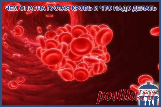 ЧЕМ ОПАСНА ГУСТАЯ КРОВЬ И ЧТО НАДО ДЕЛАТЬ?
Некоторые знают, что густую кровь надо разжижать. Замедленный кровоток приводит к кислородному голоданию внутренних органов. И к возможному образованию тромбов.
Итак, что нужно делать, чтобы кровь свободно циркулировала. Несколько простых советов.
Профилактика образования тромбов
1. Пейте больше воды! 90% людей пьют очень мало воды. Речь именно о кипя