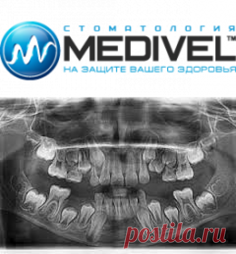 Рентген зубов в частной стоматологическом центре "Medivel" | MEDIVEL