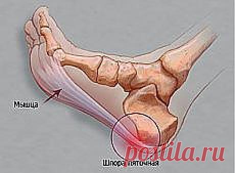 шпоры | Фотографии и советы на Постиле