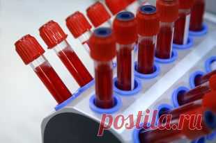 О чем расскажет общий анализ крови