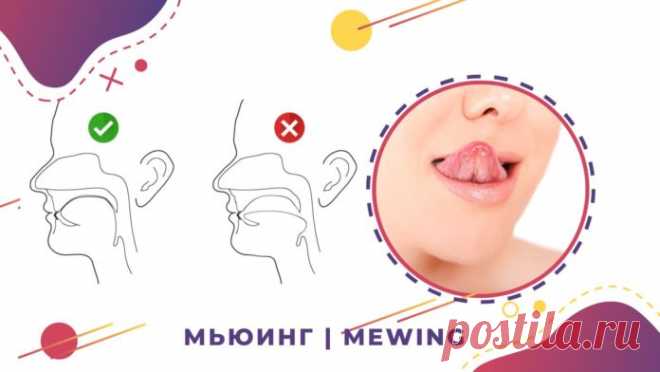 Как мьюинг исправит осанку, угол молодости и нечеткий овал лица - Леди Молодость