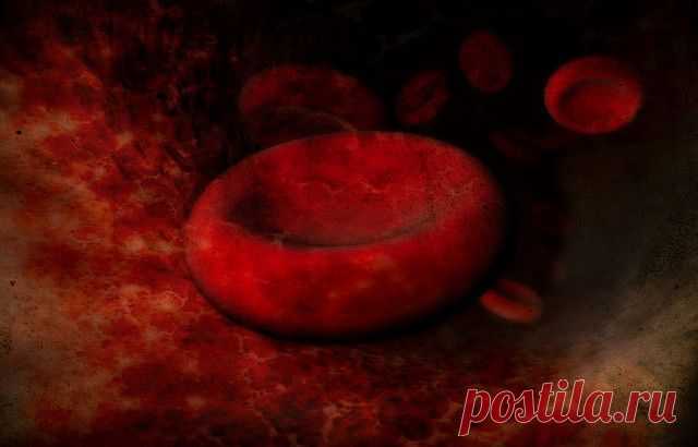 Анемия: причины, симптомы, степени, лечение