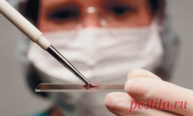 9 показателей крови, которые расскажут все о вашем здоровье
