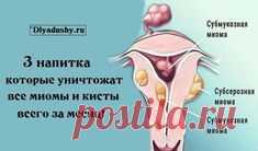 3 напитка которые уничтожат все миомы и кисты всего за месяц!Невероятно, что можно так просто от них избавиться,но это действует! Берем на заметку! Миома — доброкачественная опухоль, возникающая в матке. И число женщин с миомой очень велико. #здоровье #красота #помощь #dlyadushy #полезныесоветы #советы