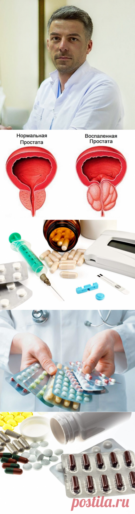 Таблетки от простатита ⋆ Список самых эффективных препаратов ⋆