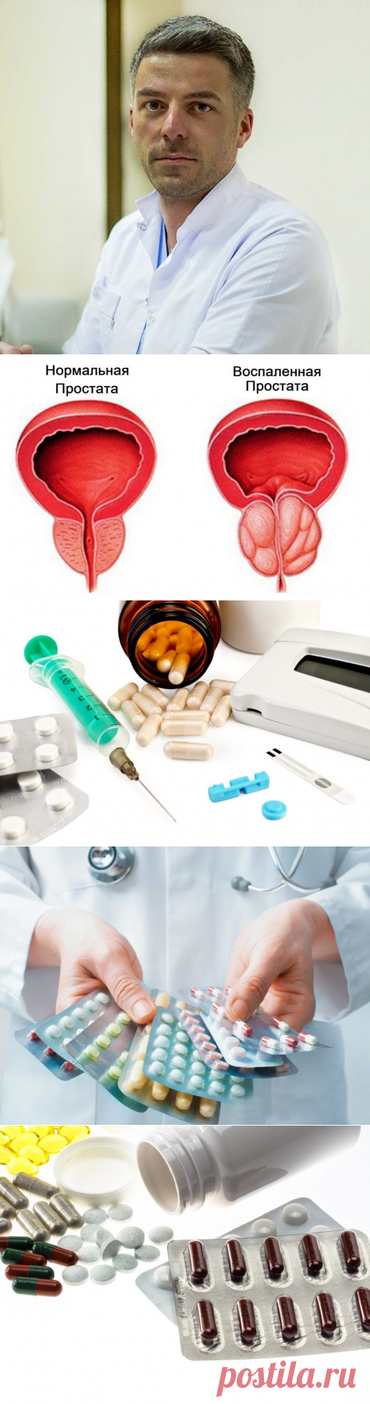 Таблетки от простатита ⋆ Список самых эффективных препаратов ⋆