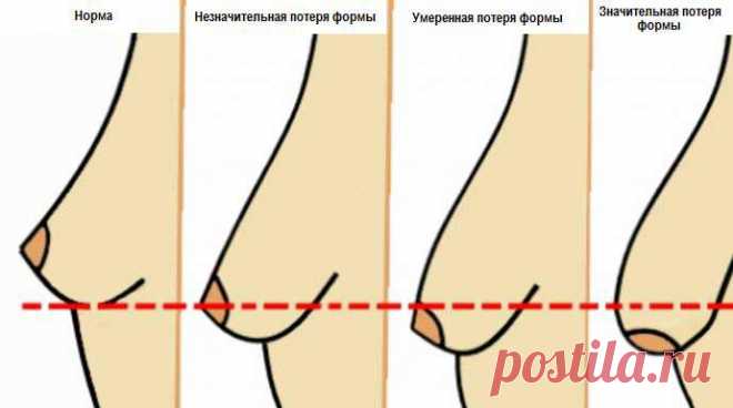 5 мифов о провисании груди, и как этого избежать!