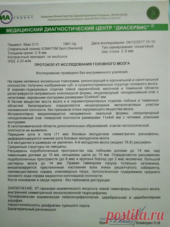 ПОЛИФОКАЛЬНАЯ ИШЕМИЧЕСКАЯ ЛЕЙКОЭНЦЕФАЛОПАТИЯ - Google Search