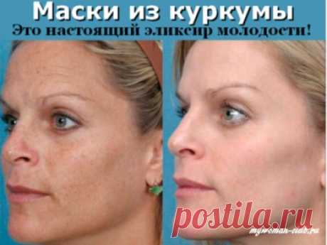 Маски Из Куркумы — Находка Для Кожи » mywoman-club