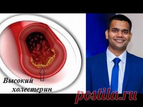 Если У Вас Есть Эти Симптомы, Вам Нужно Проверить Уровень Холестерина