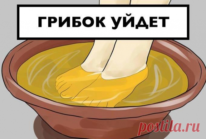 ВЫ ОНЕМЕЕТЕ! ГРИБОК ЗАСОХНЕТ ПОД КОРЕНЬ, ЕСЛИ... Я забыла, что это такое!