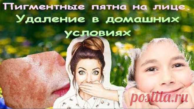 Пигментные пятна на лице. Удаление в домашних условиях.