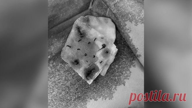 Российские врачи спасли пациента с 14 тромбами в мозге. Врачи сосудистого центра больницы в Орехово-Зуеве спасли 50-летнего пациента с инсультом. Об этом сообщили в пресс-службе Минздрава Московской области. Мужчина поступил в медицинское учреждение с нарушением двигательной функции, ...