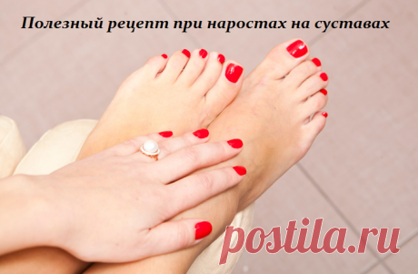 Полезный рецепт при наростах на суставах
