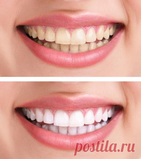 Как отбелить зубы — природные ингредиенты для прекрасной улыбки