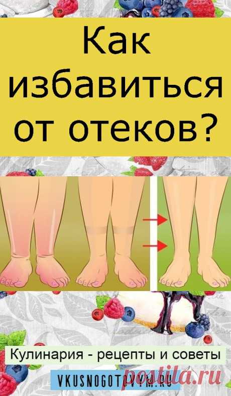 Как избавиться от отеков?